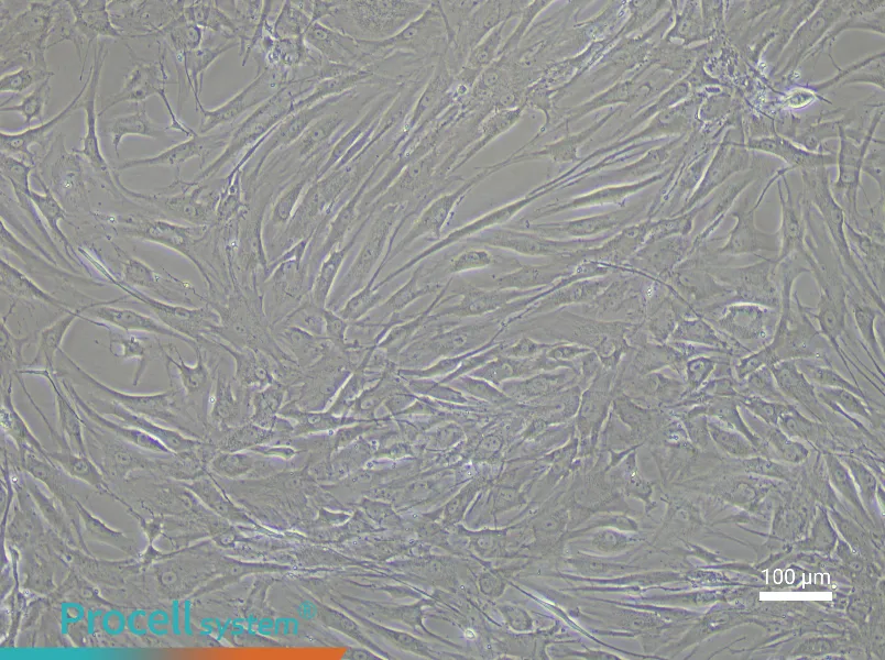 Human Corneal Stromal Cell Complete Medium - 1