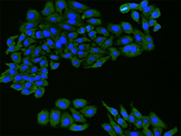 Immunofluorescence analysis of hepG2 cell  using FLT1 Polyclonal Antibody at dilution of 1:100