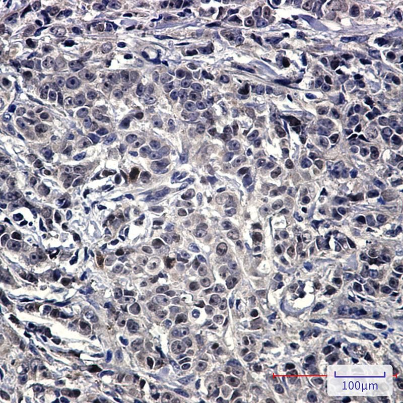 Recombinant NOLC1 Monoclonal Antibody - 3