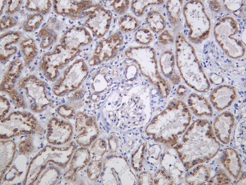 Recombinant GBA Monoclonal Antibody - 2