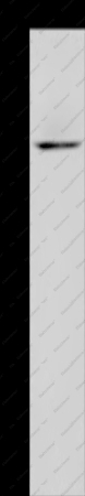 HYAL3 Polyclonal Antibody - 1