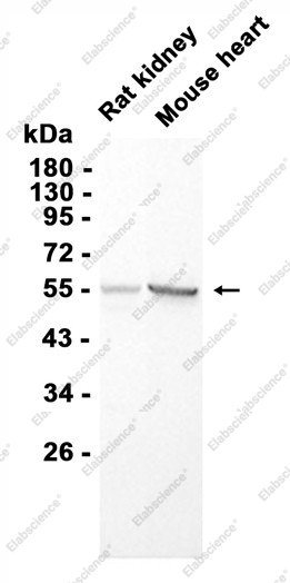 Recombinant Cytochrome P450 17A1/CYP17A1 Monoclonal Antibody - 1