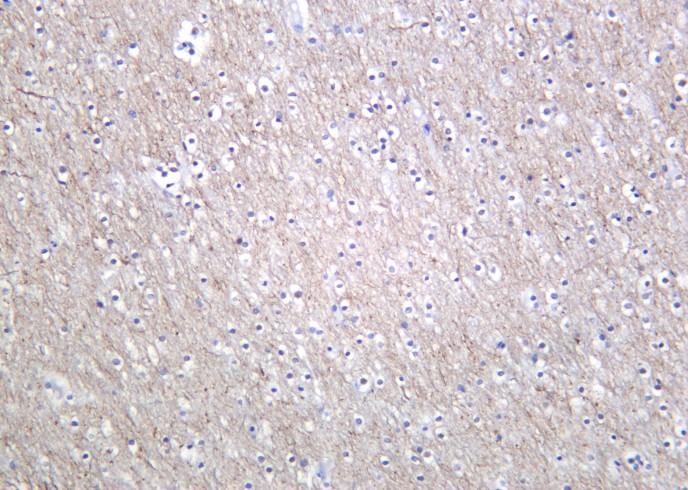 Recombinant Phospho-Tau (Ser396) Monoclonal Antibody - small - 2