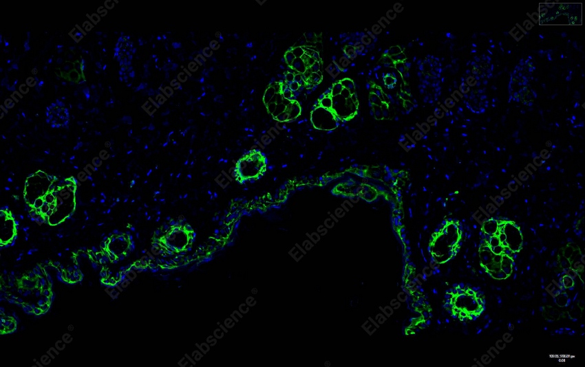 Recombinant Claudin-1 Monoclonal Antibody - 10