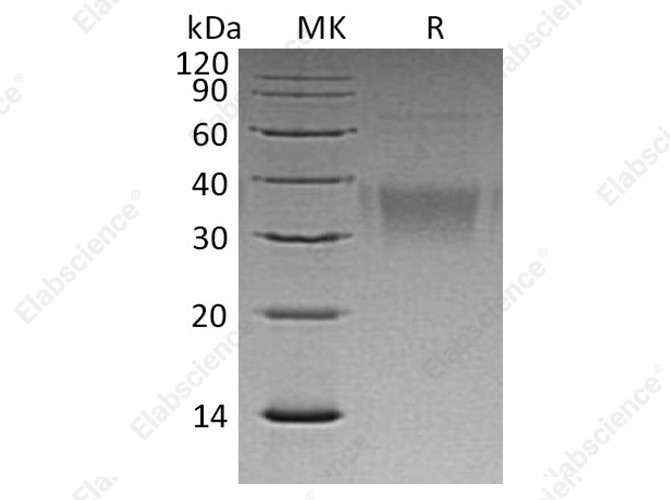 Recombinant Human Ephrin-B2/EFNB2 Protein (His Tag) - 1