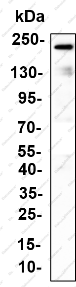 Recombinant Myosin Heavy Chain, Smooth Muscle (SMMHC) Monoclonal Antibody - 5