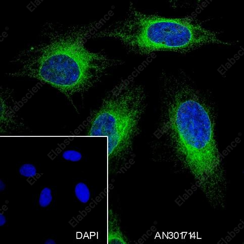Recombinant BAP29 Monoclonal Antibody - 4