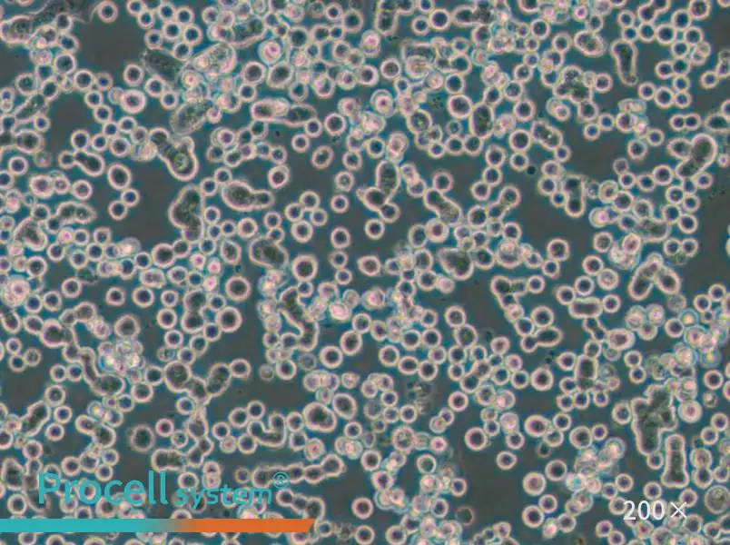 MDA-MB-134-VI (L15) Cell Complete Medium - 5