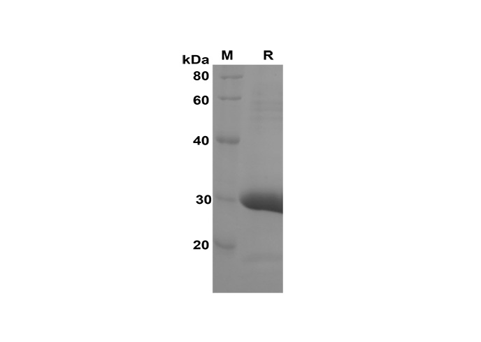Recombinant Mouse IL-10 Protein(His Tag)-产品推荐-1