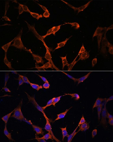 Immunofluorescence analysis of NIH/3T3 cells using HLA-DPB1 Polyclonal Antibody at dilution of 1:100. Blue: DAPI for nuclear staining.