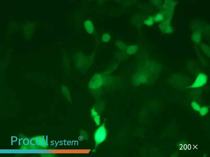 MC38-GFP - 5