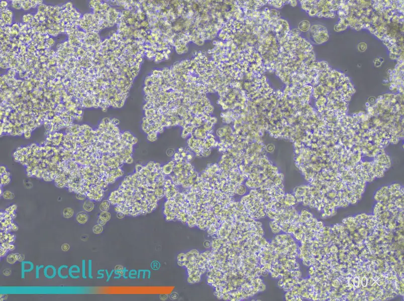NCI-H187 Cell Complete Medium - 1