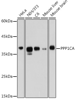 Western blot analysis of extracts of various cell lines using PPP1CA Polyclonal Antibody at 1:1000 dilution.