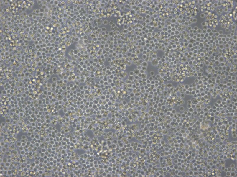 DoHH2 Cell Complete Medium - 6