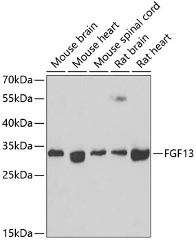 Western blot analysis of extracts of various cell lines using FGF13 Polyclonal Antibody at 1:1000 dilution.