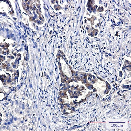 Recombinant NPC2 Monoclonal Antibody - 3