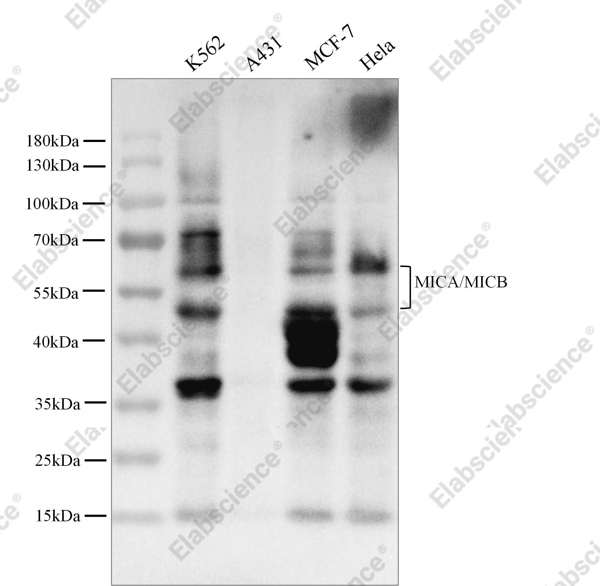 Recombinant MICB Monoclonal Antibody - 1