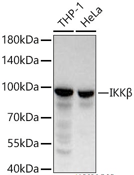 IKK beta Polyclonal Antibody - small - 5