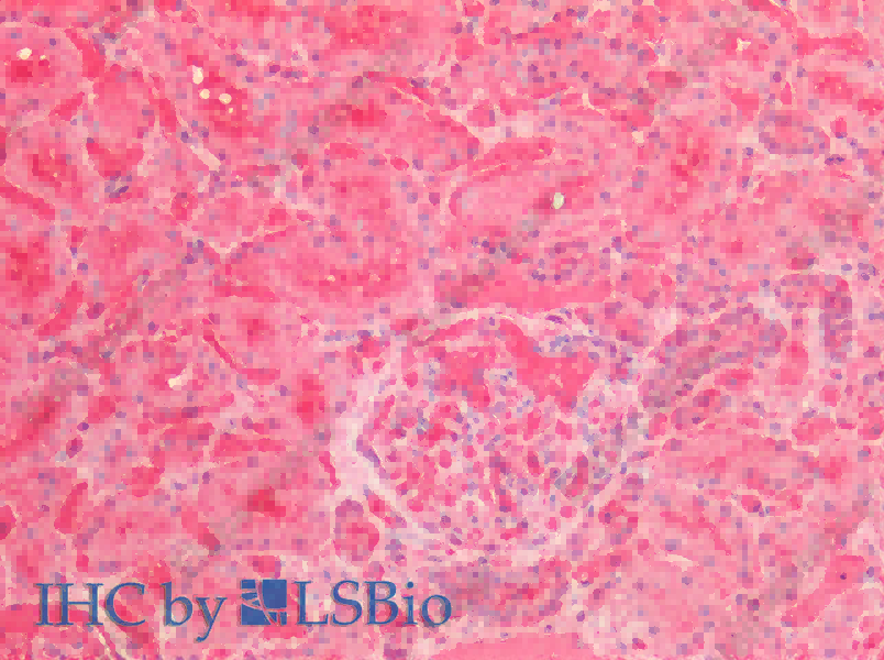 ENO1 Polyclonal Antibody - 4
