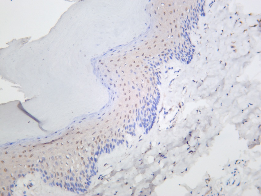Recombinant p21 Monoclonal Antibody - 2