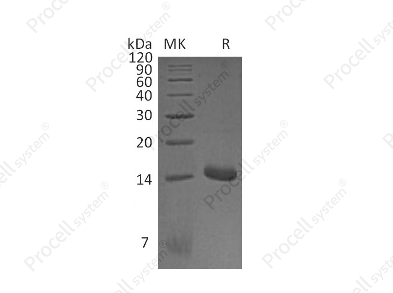 MIP-1&alpha;/CCL3 (N-6His), Mouse, Recombinant