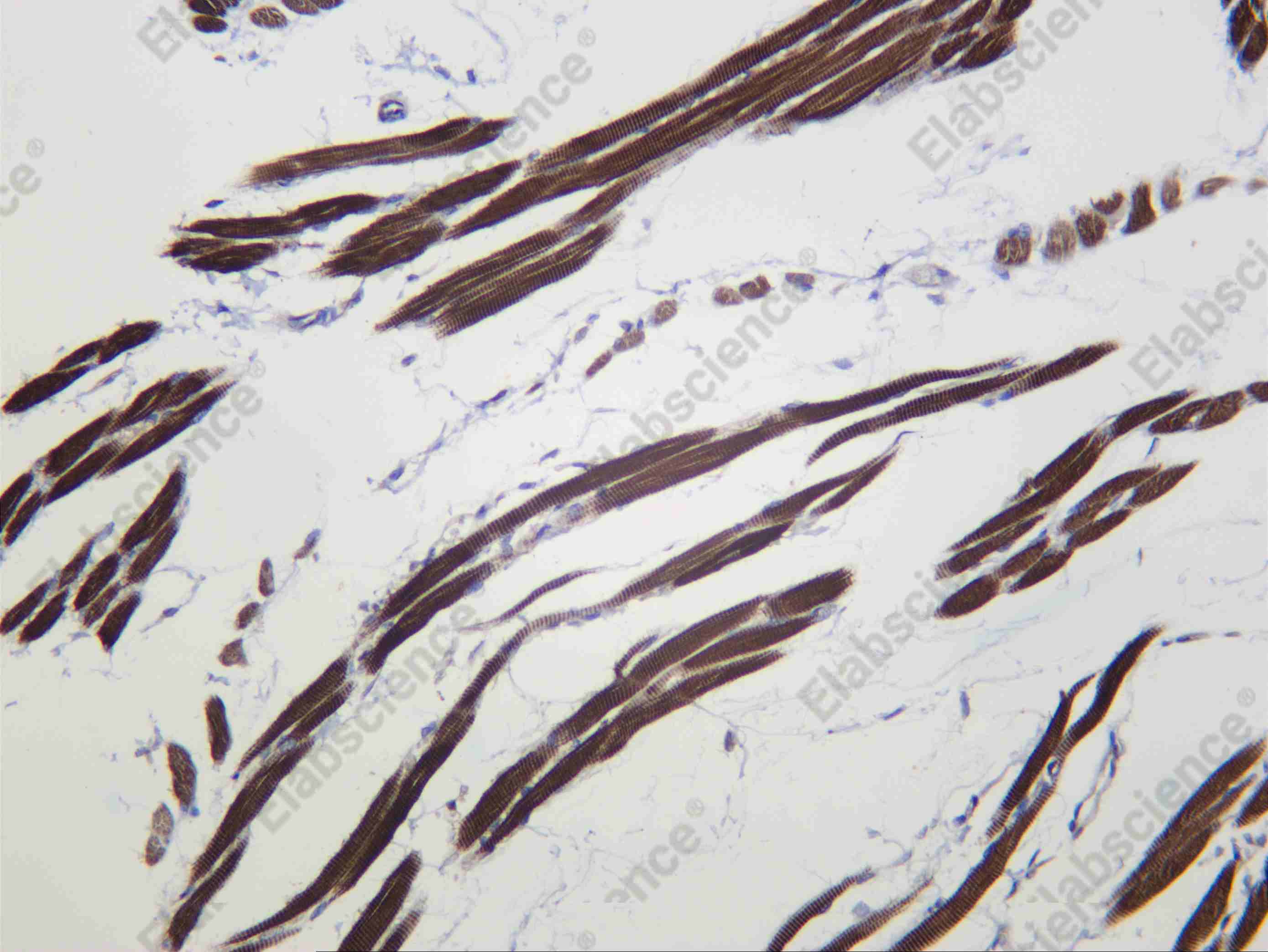 Recombinant Alpha skeletal muscle Actin Monoclonal Antibody - 3