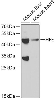 Western blot analysis of extracts of various cell lines using HFE Polyclonal Antibody at 1:1000 dilution.