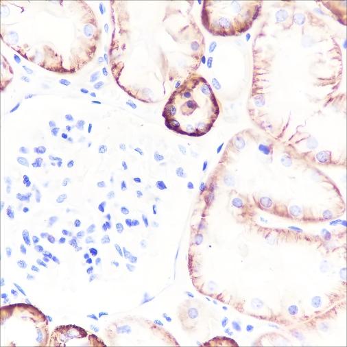Recombinant Na+/K+ ATPase alpha-1 Monoclonal Antibody - 3