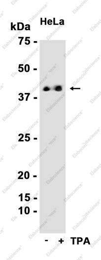Recombinant Phospho-ERK1/2 (Thr202/Thr185) Monoclonal Antibody - 3