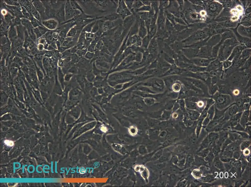 SK-GT-4 Cell Complete Medium - 5