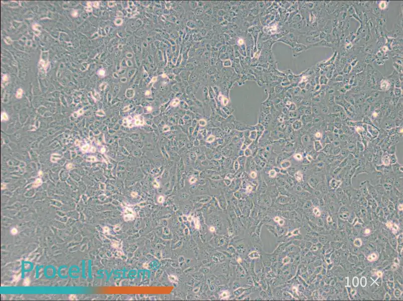 B-CPAP [BC-PAP; BCPAP] Cell Complete Medium - 1
