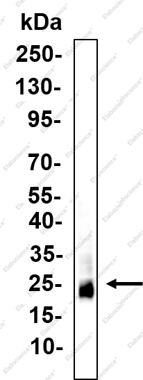 Recombinant SIGMAR1 Monoclonal Antibody - 3