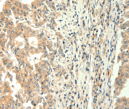 TRPM5 Polyclonal Antibody - 3