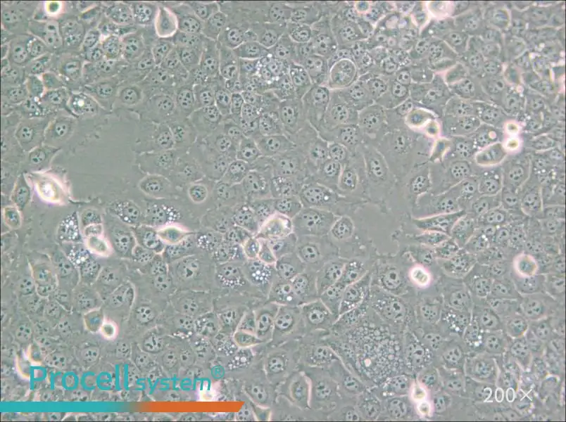 KYSE-30 Cell Complete Medium - small - 4