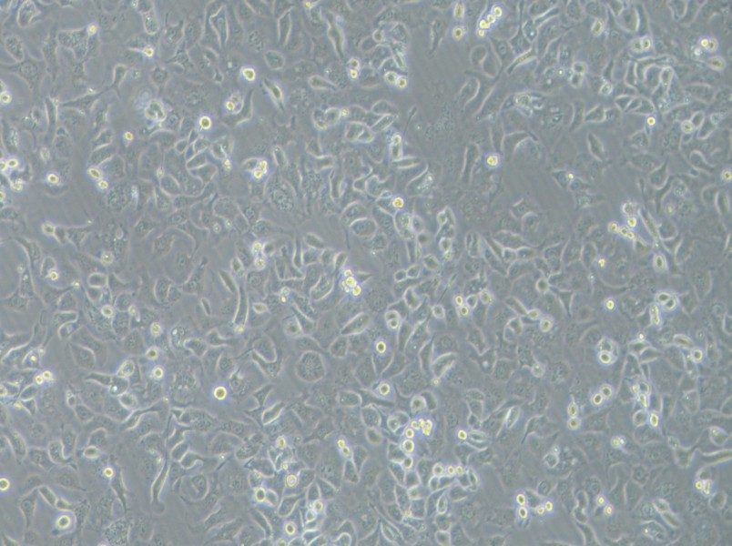 IGROV-1 Cell Complete MediumIGROV-1 Cell Complete Medium - 3