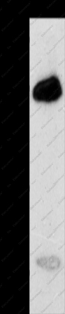 CA14 Polyclonal Antibody - 1