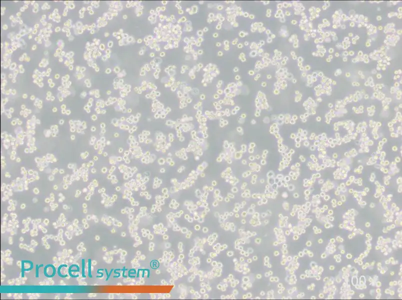 LLC-WRC 256 [Walker 256] Cell Complete Medium - 1