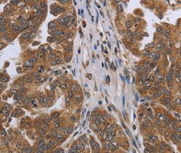 NDUFAF4 Polyclonal Antibody - 2