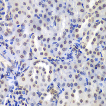 Immunohistochemistry of paraffin-embedded Mouse kidney using PRKCB Polyclonal Antibody at dilution of  1:200 (40x lens).