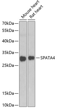 Western blot analysis of extracts of various cell lines using SPATA4 Polyclonal Antibody at 1:1000 dilution.