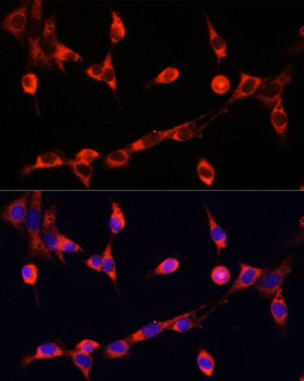 Immunofluorescence analysis of NIH/3T3 cells using CHAT Polyclonal Antibody at dilution of  1:100. Blue: DAPI for nuclear staining.