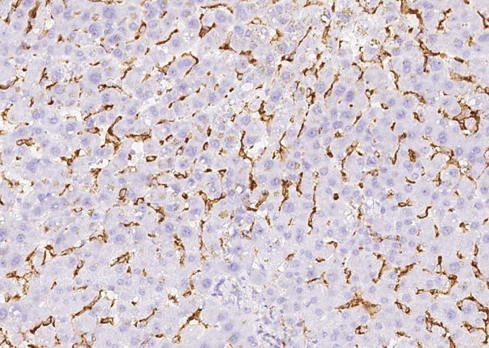 CD16b/FCGR3B Monoclonal Antibody-searchlist-1
