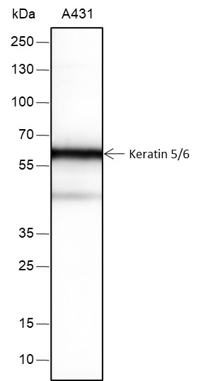 Recombinant Keratin 5/6 Monoclonal Antibody-searchlist-1