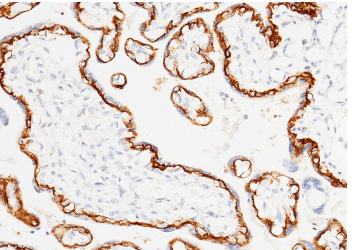 TROP2/TACSTD2 Monoclonal Antibody - small - 2