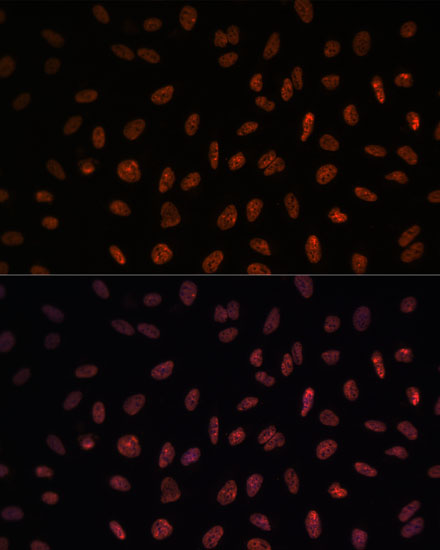 Immunofluorescence analysis of U-2 OS cells using MATR3 Polyclonal Antibody at dilution of  1:100. Blue: DAPI for nuclear staining.