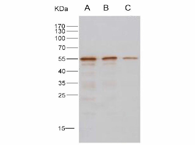 Western Blot analysis of Recombinant MERS-CoV Nucleoprotein / NP protein (His Tag)(PKSV030235 with 10ng, 5ng and 2ng ) using Anti-MERS-CoV Nucleocapsid Protein Polyclonal Antibody at dilution of 1:1000.