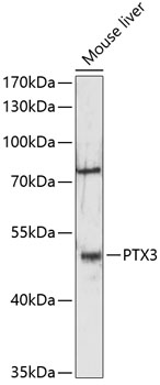 Western blot analysis of extracts of mouse liver using PTX3 Polyclonal Antibody at 1:3000 dilution.