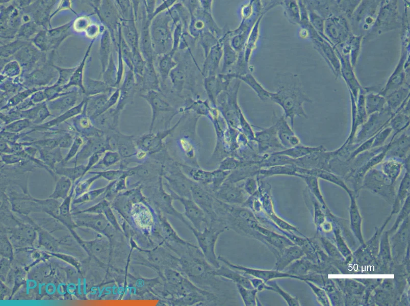 Rat Pulmonary Artery Smooth Muscle Cells - 5