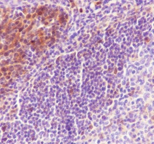 Recombinant TMS1/ASC Monoclonal Antibody - small - 4