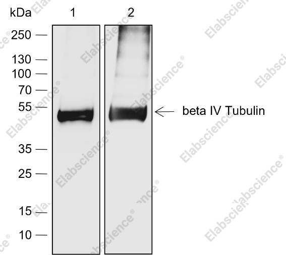 Recombinant beta IV Tubulin Monoclonal Antibody - 2